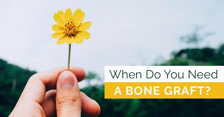 when do you need a bone graft 