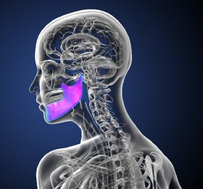 x-ray image of jaw pain